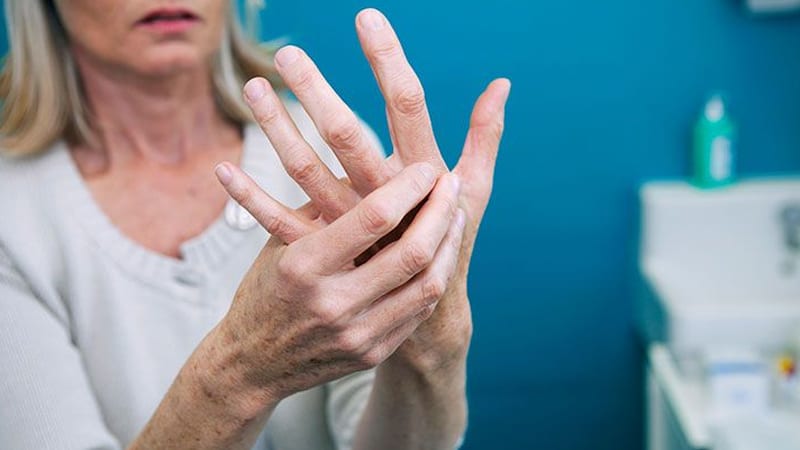 a woman with finger osteoarthritis
