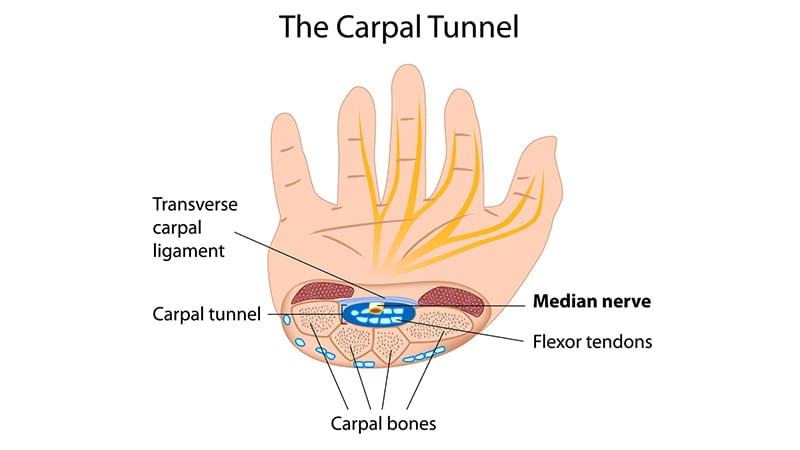 a diagram explaining carpal tunnel