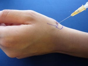 a hand being injected with medicine to treat osteoarthritis